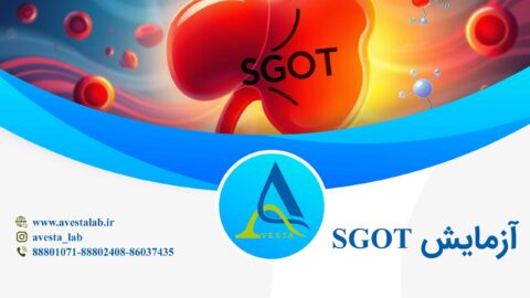 آزمایش SGOT
