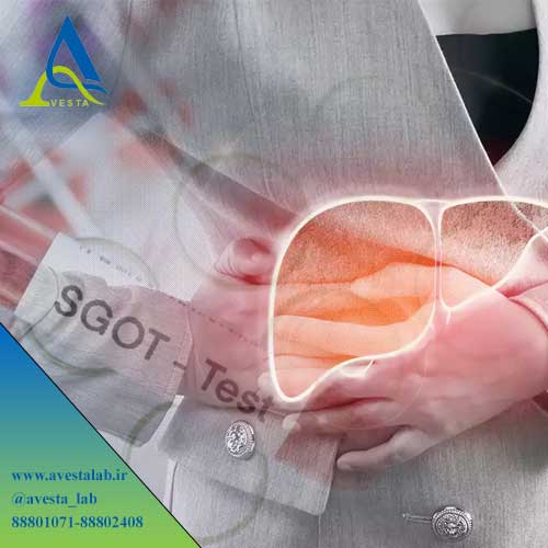 آزمایش SGOT