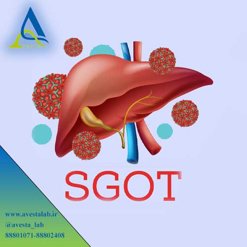 آزمایش SGOT