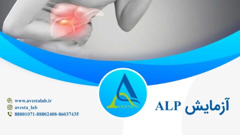آزمایش آلکالین فسفاتاز ALP