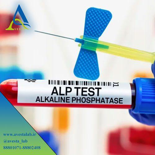 آزمایش آلکالین فسفاتاز ALP