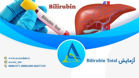 آزمایش بیلی روبین تام (خون)