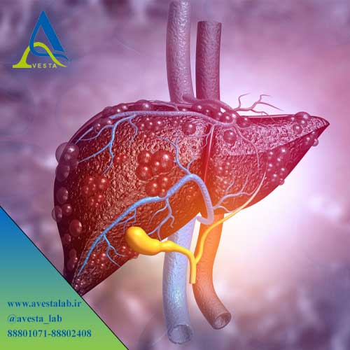 آزمایش گاما گلوتامیل ترانسفراز (GGT)