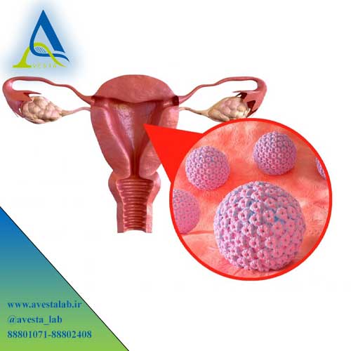 ویروس پاپیلومای انسانی HPV
