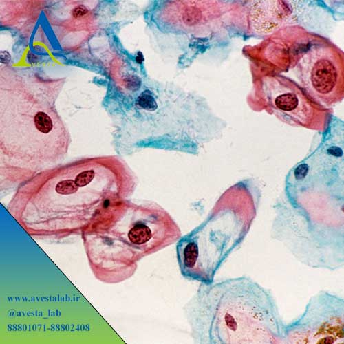 آزمایش HPV در آزمایشگاه پاتوبیولوژی اوستا