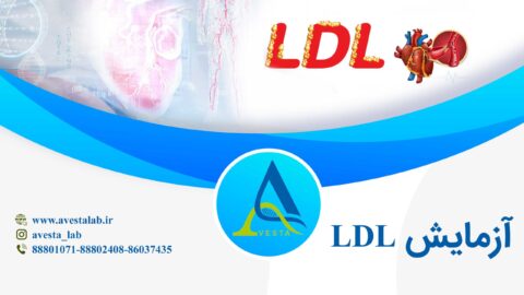 آزمایش LDL