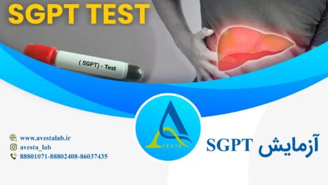 آزمایش SGPT