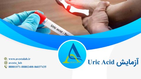 آزمایش Uric Acid