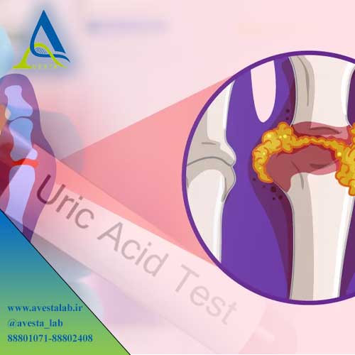 آزمایش Uric Acid
