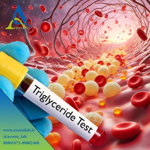 آزمایش تری گلیسیرید Triglycerides