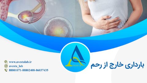 بارداری خارج از رحم