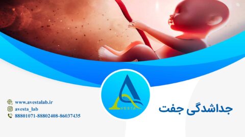 جداشدگی جفت