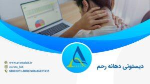 دیستونی دهانه رحم