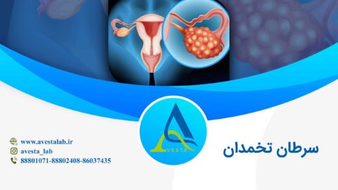 سرطان تخمدان