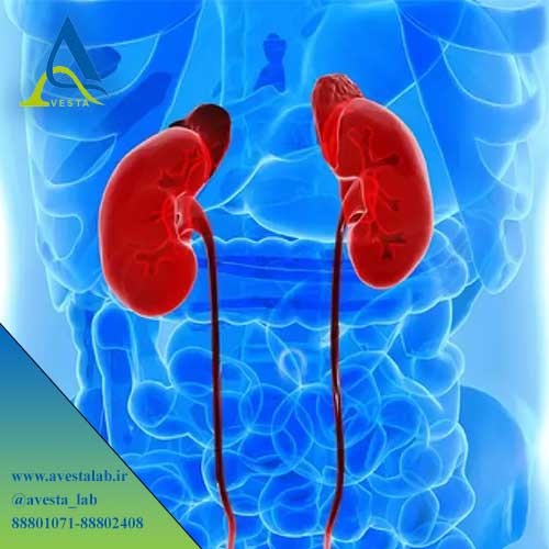 آزمایش آلدوسترون Aldosterone