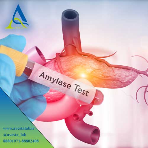 آزمایش آمیلاز Amylase