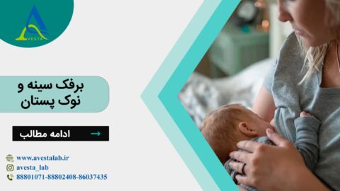 برفک سینه و نوک پستان