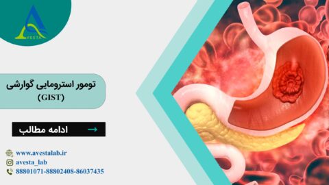 تومور استرومایی گوارشی (GIST)
