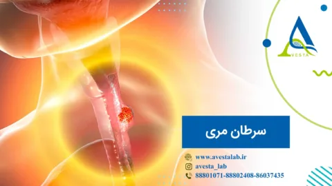سرطان مری