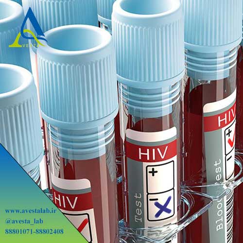 HIV و AIDS