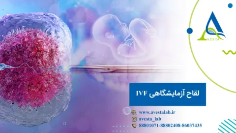 لقاح آزمایشگاهی IVF