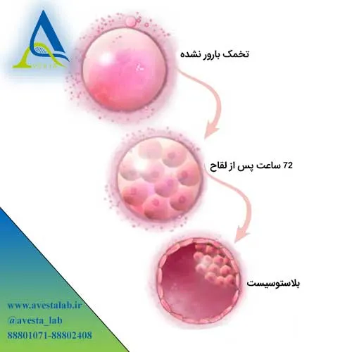 لقاح آزمایشگاهی IVF