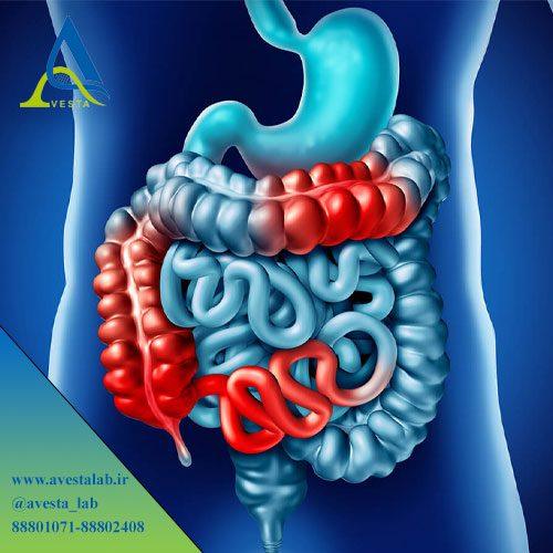 بیماری التهابی روده (IBD)