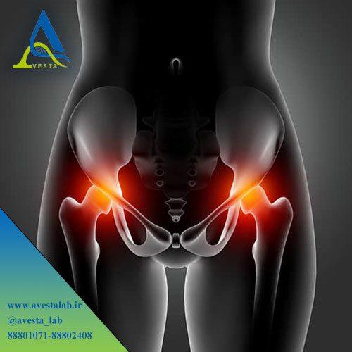 بیماری التهابی لگن PID