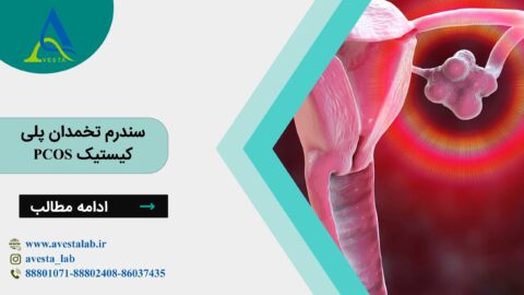 سندرم تخمدان پلی کیستیک PCOS