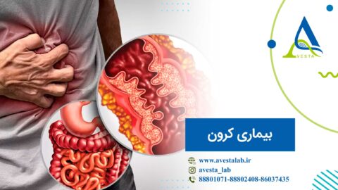 بیماری کرون