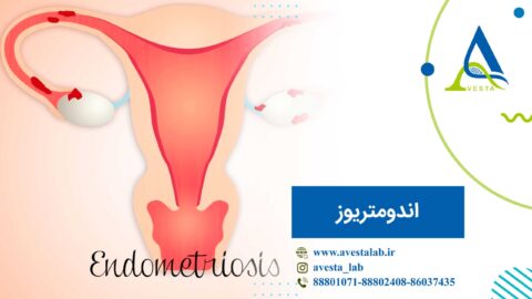 اندومتریوز