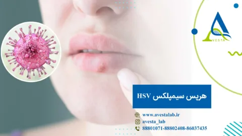 ویروس هرپس سیمپلکس HSV