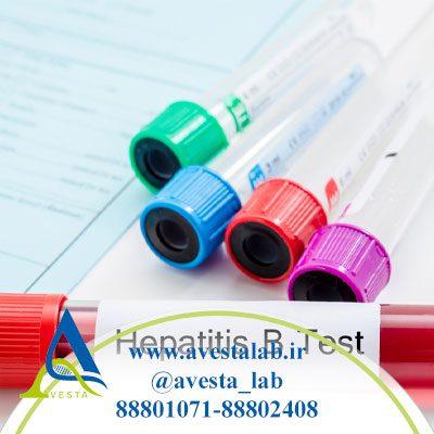 آزمایشات قبل از ازدواج