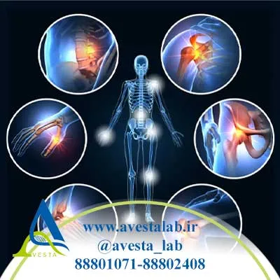 آرتریت روماتوئید چیست؟
