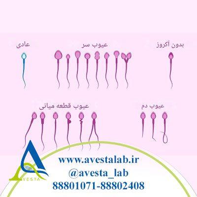 اختلالات اسپرم