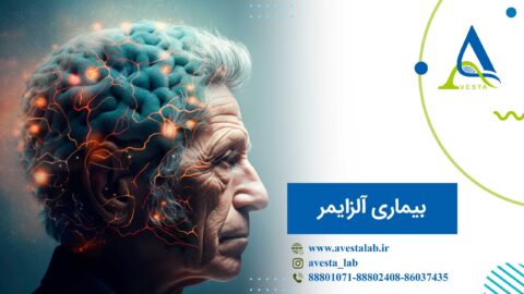 بیماری آلزایمر