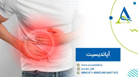 آپاندیسیت