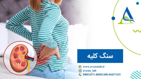سنگ کلیه چیست؟