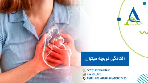 افتادگی دریچه میترال