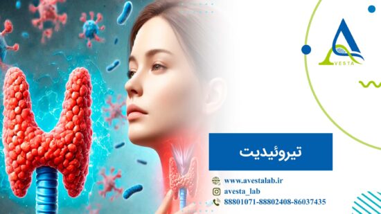 تیروئیدیت