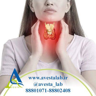 تیروئیدیت