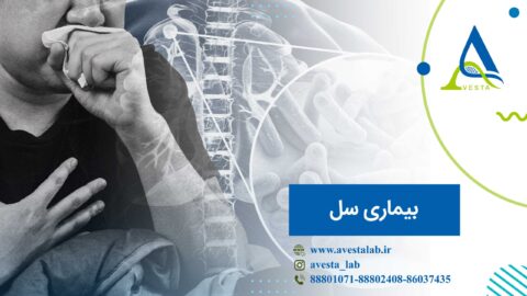 سل چیست؟