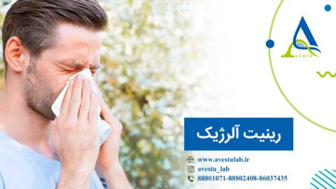 رینیت آلرژیک (تب یونجه)