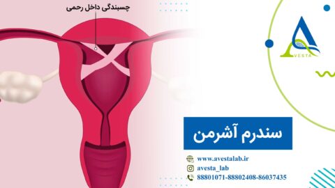 سندرم آشرمن چیست؟