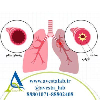 برونشیت چیست؟