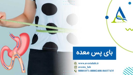 جراحی بای پس معده