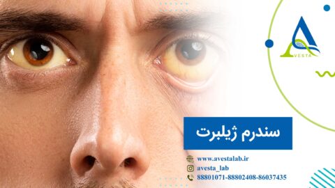 سندرم ژیلبرت