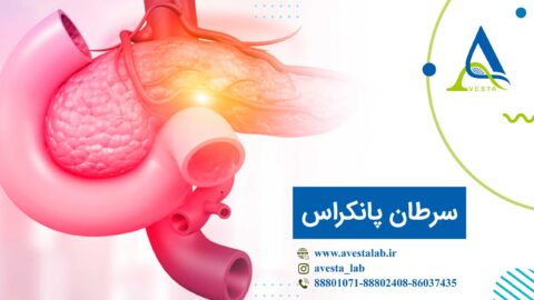 سرطان پانکراس