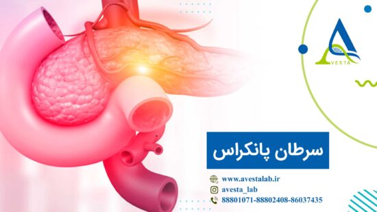 سرطان پانکراس