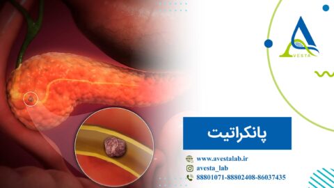 پانکراتیت